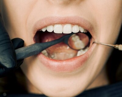 Cleanings + Preventative